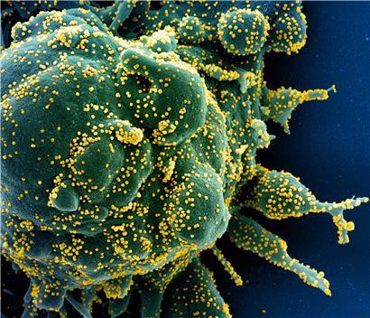Auf dieser vom US-Forschungszentrum „National Institute of Allergy and Infectious Diseases“ (Niaid) zur Verfügung gestellten Aufnahme vom 13. Februar ist eine Zelle (grün) mit dem Coronavirus (Sars-CoV-2, gelb) infiziert. Die Probe wurde von einem Patienten in den USA isoliert.

