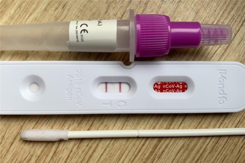 Bereits bei einem positiven Schnelltest sollte man alle engen Kontakte der letzten 48 Stunden informieren – und damit nicht erst bis zum Ergebnis des PCR-Tests warten
