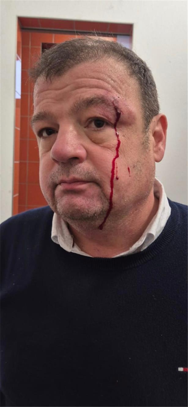 Nach Attacke: Schiedsrichter will weitermachen 