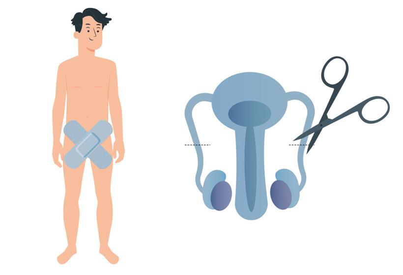 Wie verlaufen Vasektomien? – Ein Urologe und ein Patient geben Erklärungen 