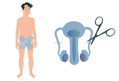 Wie verlaufen Vasektomien? – Ein Urologe und ein Patient geben Erklärungen