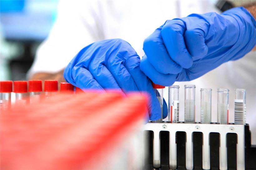 Corona-Wochenrückblick der „Santé“ zeigt Anstieg der Infektionen und Tests – drei Tote 