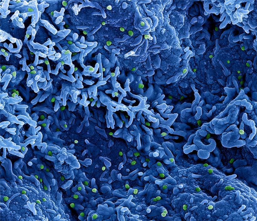 „Man darf niemanden stigmatisieren“: Wie die Definition der Affenpocken-Risikogruppen zustande kommt 