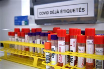 „Santé“ meldet 700 Infektionen über das Wochenende – keine weiteren Todesfälle