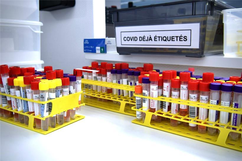 „Santé“ meldet am Dienstag: 1.060 von 3.781 Tests positiv – eine weitere Person stirbt 