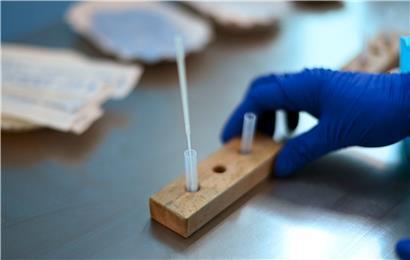 Santé meldet 131 Neuinfektionen am Donnerstag – Zahl der Toten bleibt bei 819