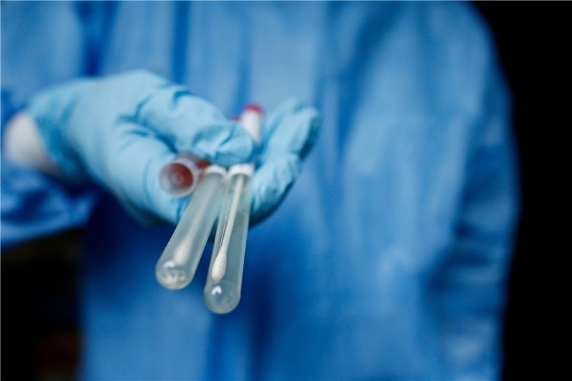 „Santé“ meldet am Donnerstag 67 Neuinfektionen bei 6.100 Tests 