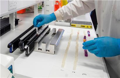 Bluttests müssen zeigen, ob es sich um eine simple Grippe oder das Coronavirus handelt
