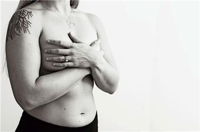 Brustkrebs ist die häufigste Krebserkrankung bei Frauen in Luxemburg, schreibt die Fondation Cancer 
