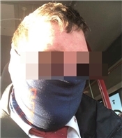 CFL Schutzmaske schal