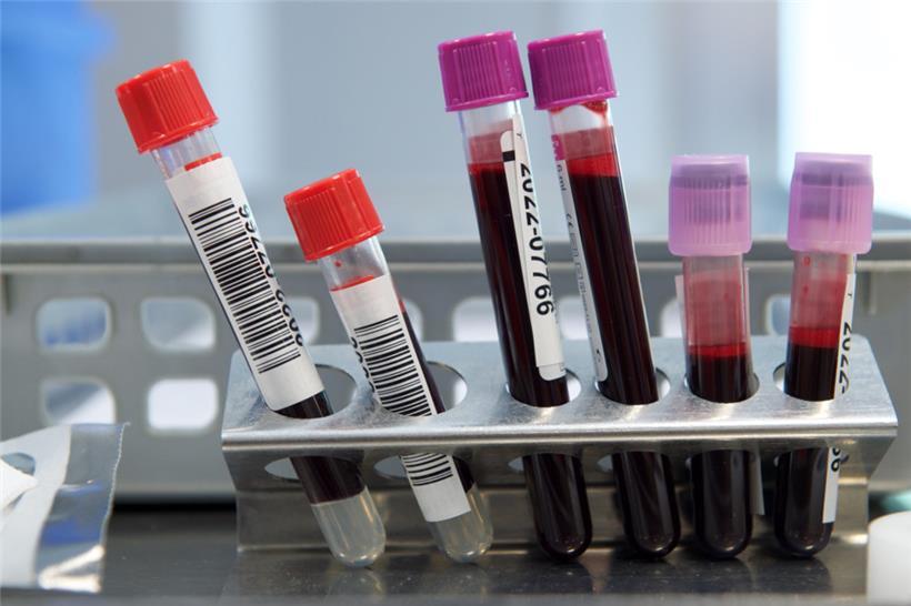 Das Gesundheitswesen ist auf Blutspenden angewiesen
