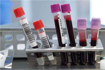 Das Gesundheitswesen ist auf Blutspenden angewiesen
