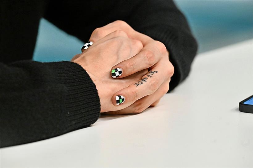 Der 27-Jährige trägt ein besonderes Markenzeichen
