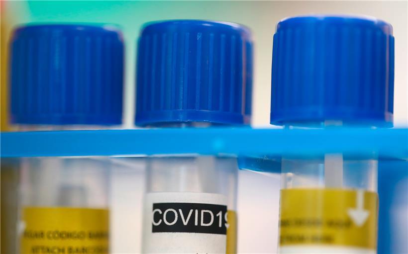 Der Test auf das Coronavirus wird in Luxemburg von verschiedenen Laboren durchgeführt
