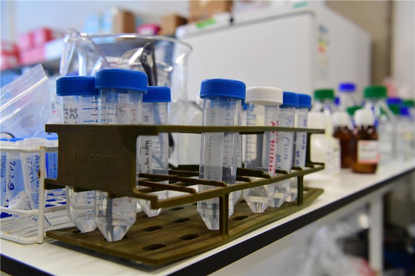 Der menschliche Darm spielt eine wichtige Rolle für das Immunsystem
