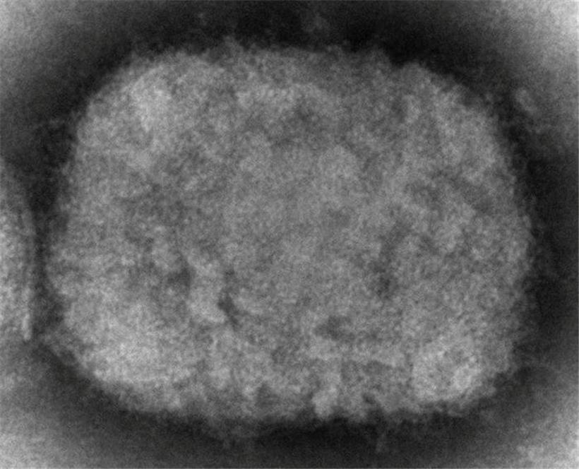 Diese elektronenmikroskopische Aufnahme aus dem Jahr 2003 zeigt ein Affenpockenvirus, das aus einer Probe im Zusammenhang mit dem Präriehundeausbruch von 2003 stammt
