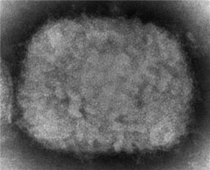 Diese elektronenmikroskopische Aufnahme aus dem Jahr 2003 zeigt ein Affenpockenvirus, das aus einer Probe im Zusammenhang mit dem Präriehundeausbruch von 2003 stammt
