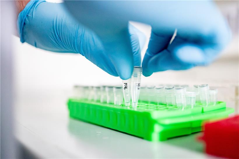 Ein Doktorand der Heinrich-Heine-Universität Düsseldorf arbeitet an Proben für die Coronavirus-Forschung
