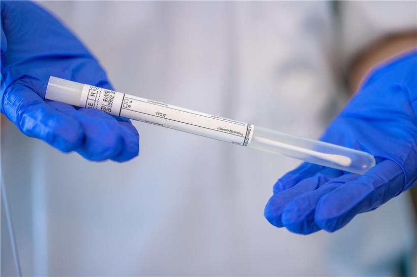 Ein Röhrchen mit dem Stäbchen für einen PCR-Abstrichtest, gehalten von einer Krankenschwester in einem Corona-Testzentrum
