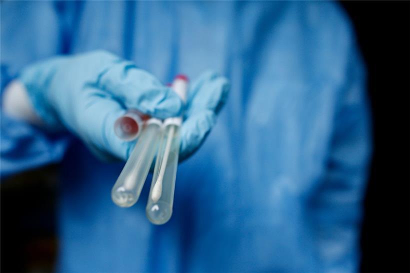 Ein neues Forschungsprojekt untersucht, wie SARS-CoV-2 das Darmmikrobiom und die Immunabwehr stört
