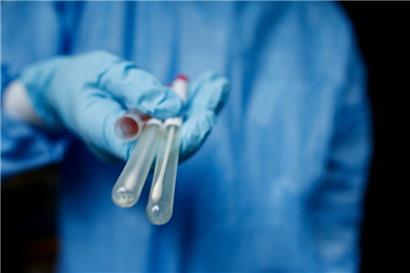 Ein neues Forschungsprojekt untersucht, wie SARS-CoV-2 das Darmmikrobiom und die Immunabwehr stört

