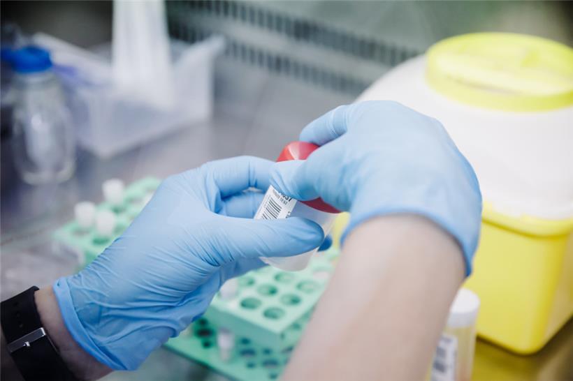 Eine Krankenschwester führt einen PCR-Test zur Erkennung des Affenpockenvirus durch
