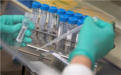 Eine Labor-Mitarbeiterin pipettiert Coronaproben
