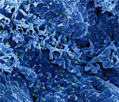 Eine kolorierte rasterelektronenmikroskopische Aufnahme des Affenpockenvirus (grün) auf der Oberfläche von infizierten VERO E6-Zellen (blau), aufgenommen in der NIAID Integrated Research Facility
