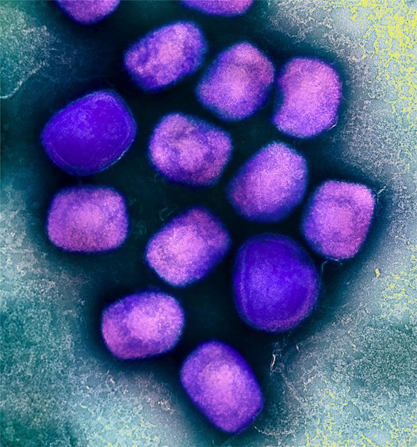 Eine kolorierte transmissionselektronenmikroskopische Aufnahme von Partikeln des Affenpockenvirus (violett), kultiviert und gereinigt aus einer Zellkultur, aufgenommen in der NIAID Integrated Research Facility
