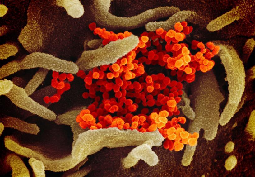 Eine undatierte elektronenmikroskopische Aufnahme des US National Institute of Health zeigt das SARS-CoV-2-Virus (orange), das aus der Oberfläche von im Labor kultivierten Zellen (grau) austritt. Die Probe wurde von einem Patienten in den USA isoliert.
