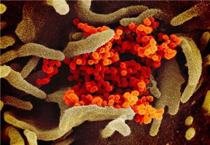 Eine undatierte elektronenmikroskopische Aufnahme des US National Institute of Health zeigt das SARS-CoV-2-Virus (orange), das aus der Oberfläche von im Labor kultivierten Zellen (grau) austritt. Die Probe wurde von einem Patienten in den USA isoliert.

