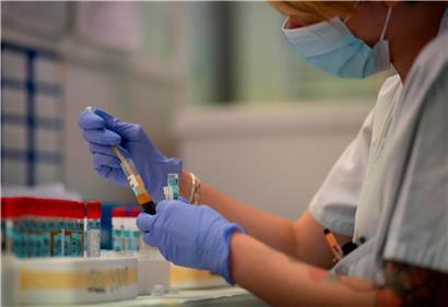 Erneut wurden drei Personen in Luxemburg positiv auf das Coronavirus getestet.
