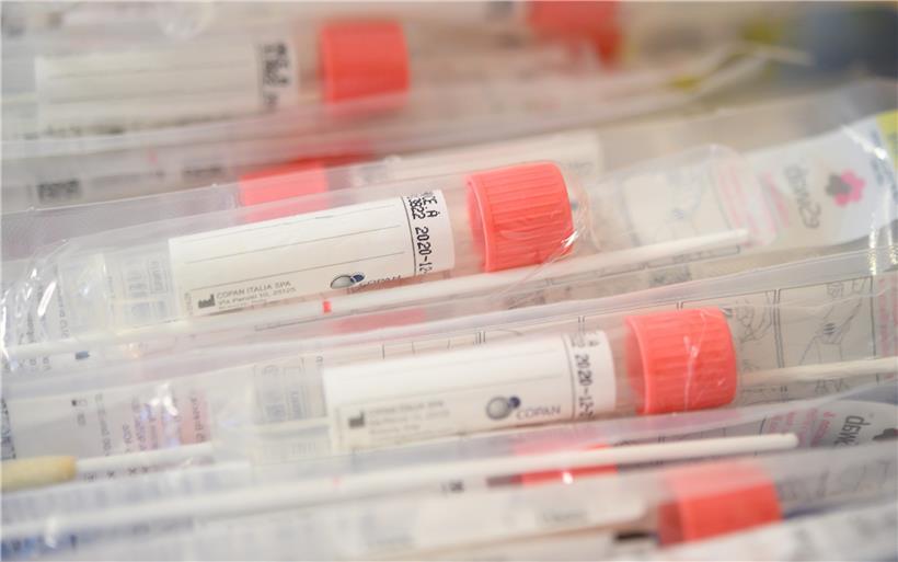 Insgesamt 5.409 Menschen in Luxemburg haben sich mit dem Coronavirus infiziert
