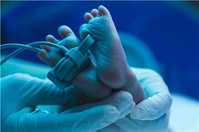 Komplikationen bei Frühgeburten sind die häufigste Todesursache bei Kindern unter fünf Jahren weltweit

