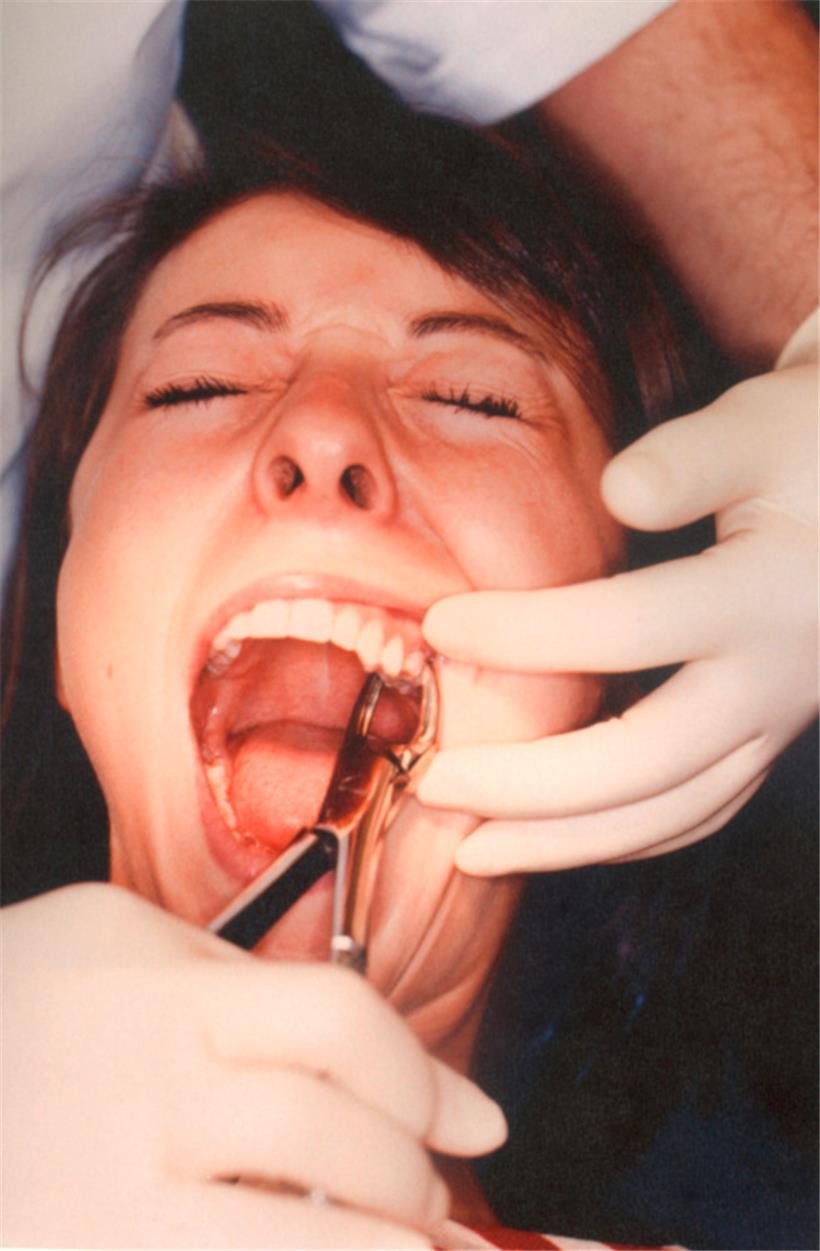 Laut Anklage hat Guedj etwa 3.900 gesunde Zähne abgetötet – im Schnitt elf pro Patient
