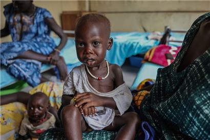 Maban im Südsudan: Adut Duor, 14 Monate alt, wird sich künftig mit kleineren Essensportionen begnügen müssen. Donald Trump braucht das Geld zur Finanzierung der Steuererleichterungen für Superreiche in den USA.
