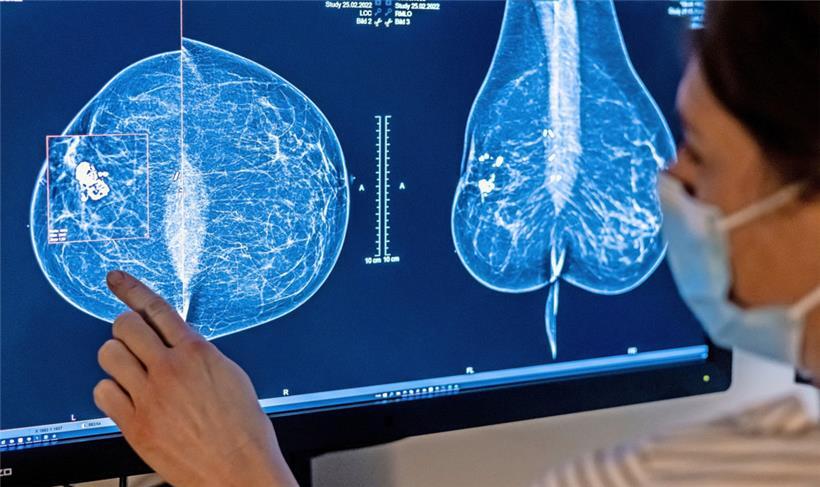 Medizinisches Personal bei der Durchführung einer Mammografie
