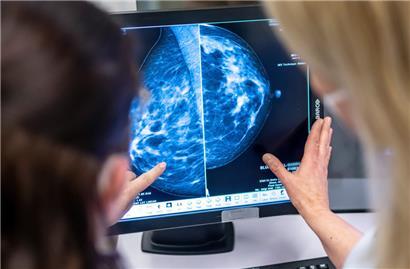 Medizinisches Personal bei der Untersuchung der Brust einer Frau mit einer Mammografie 
