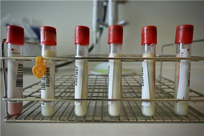 Nicht mehr ganz so lukrativ ist das Testen für die Labore
