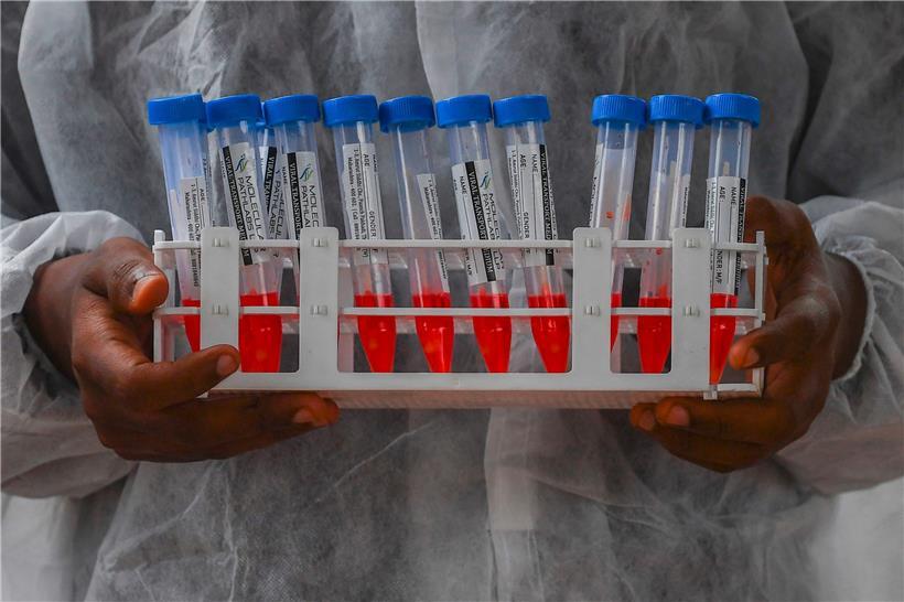 PCR-Tests werden ab dem 15. September in Luxemburg kostenpflichtig
