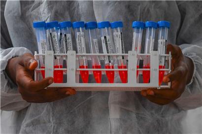 PCR-Tests werden ab dem 15. September in Luxemburg kostenpflichtig
