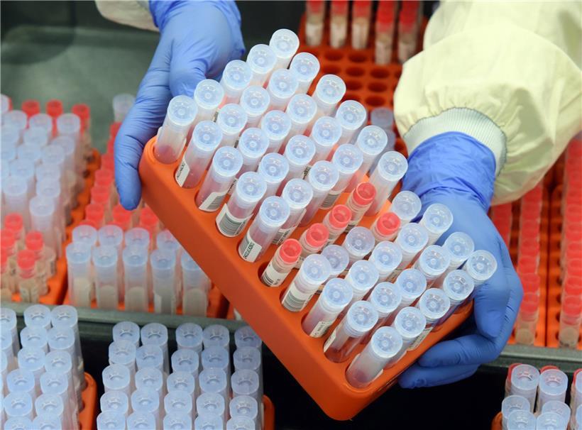 Regelmäßige PCR-Tests können ganz schön ins Geld gehen
