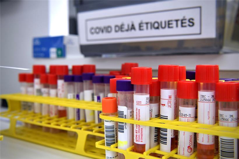 Röhrchen mit PCR-Testproben 
