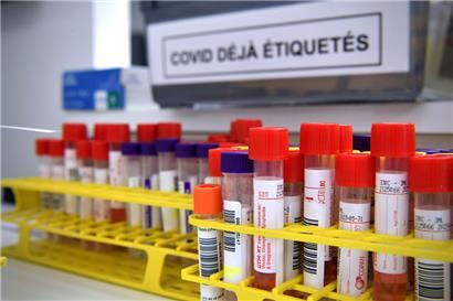 Röhrchen mit Proben für PCR-Tests in Luxemburg (Symbolfoto)
