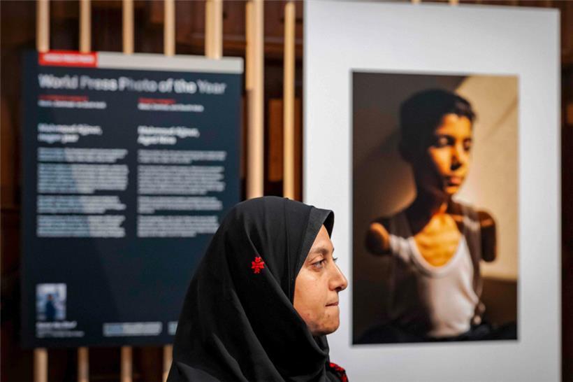 Samar Abu Elouf erhielt für ihr Foto eines palästinensischen Jungen, der durch einen Angriff der israelischen Armee auf Gaza City beide Arme verlor, den World Press Photo Award 2025
