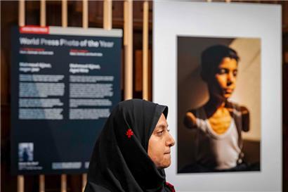 Samar Abu Elouf erhielt für ihr Foto eines palästinensischen Jungen, der durch einen Angriff der israelischen Armee auf Gaza City beide Arme verlor, den World Press Photo Award 2025
