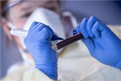 (Symbolfoto) Eine Laborantin beschriftet eine Blutprobe
