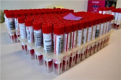 Symbolfoto: Probe-Behälter für PCR-Tests in einem Labor in Luxemburg
