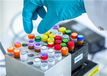 Unterschiedliche Substanzen stehen auf Kühlblöcken in einem PCR-Labor
