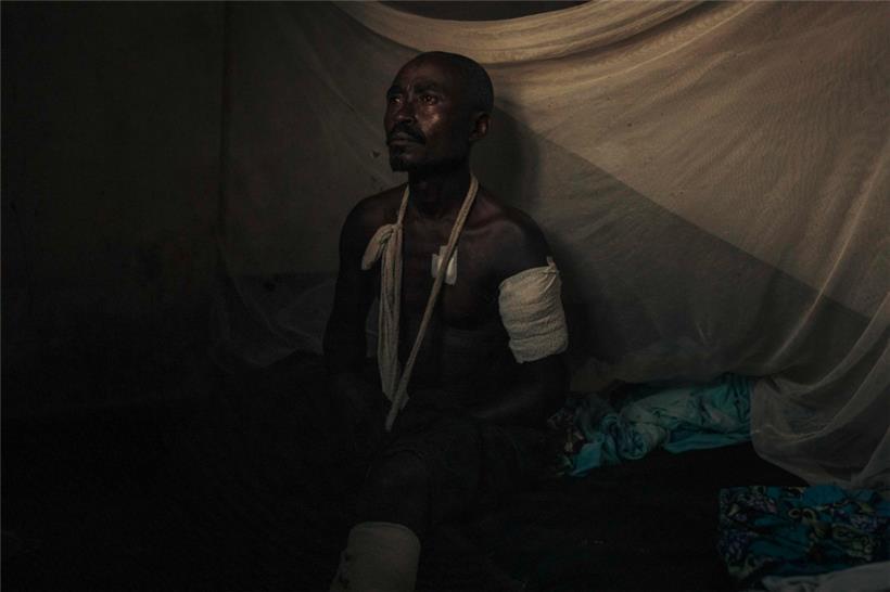 Vergessener Konflikt: Ein verwundeter kongolesischer Milizionär sitzt in einem Krankenhaus in der Nähe der Front zwischen der kongolesischen Armee und den M23-Rebellen. Das Bild ist vom 4. Mai. 
